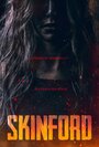 Смотреть Скинфорд на хдрезка онлайн в HD качестве 720p